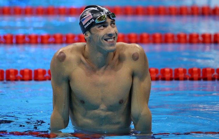Michael Phelps bringt die uralte Behandlungsmethode „cupping“ wieder in Mode