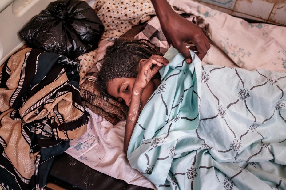Assia Abdu ist acht Jahre alt. Sie wurde in einem Dorf nahe Tigray von Granatsplittern und Schüssen getroffen