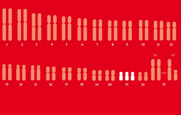 Die Erbanlagen des Menschen sind in 23 Chromosomen codiert, die paarweise vorliegen. Das Paar Nr. 23 bestimmt über das Geschlecht. Menschen mit Down-Syndrom haben drei statt zwei Chromosomen Nr. 21