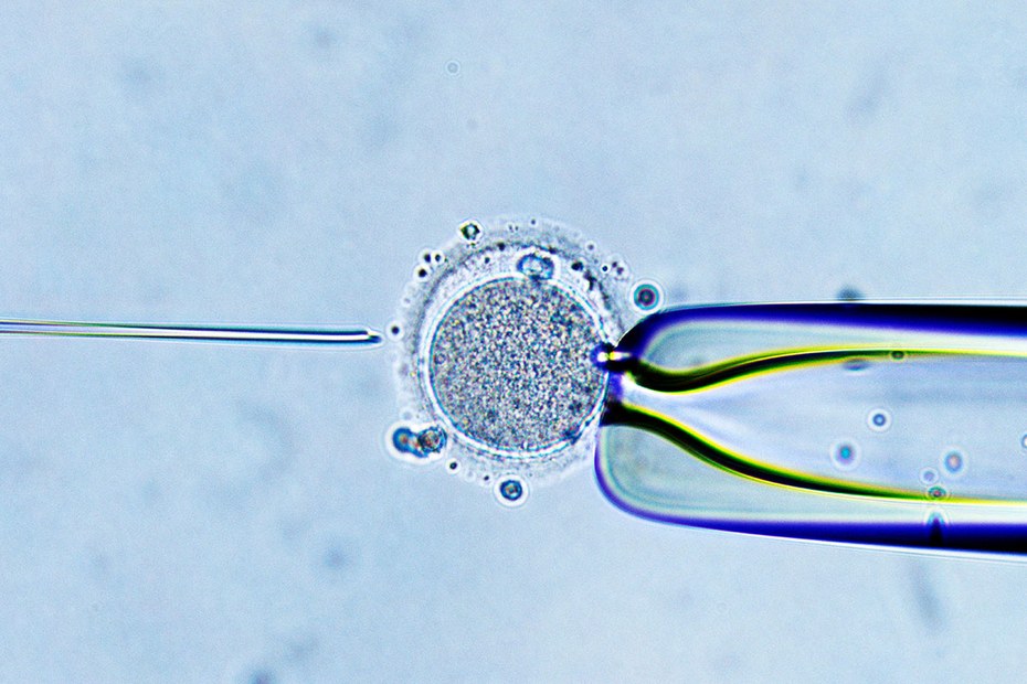 Nadel als Vater: In-vitro-Fertilisation aus mikroskopischer Sicht