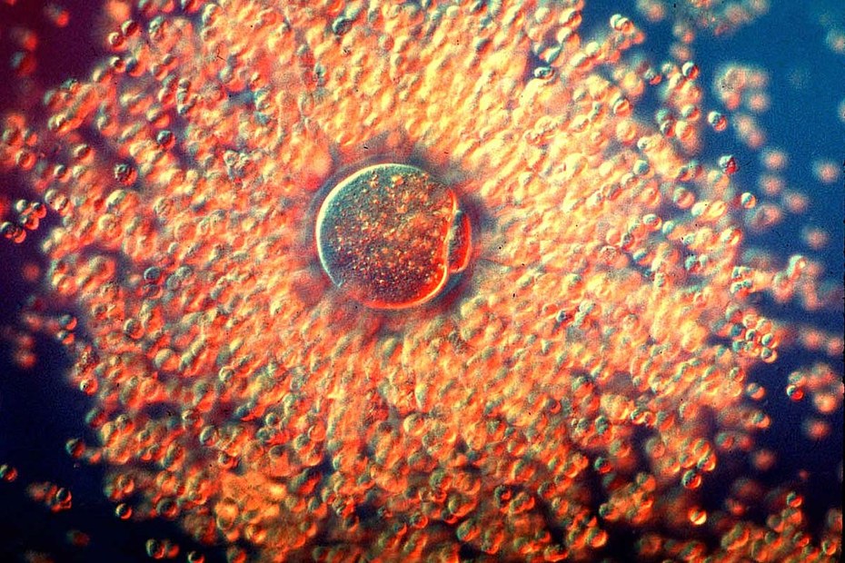 Eine von Kumuluszellen umgebene Eizelle. So sieht auch ein Teilprozess des Klonens aus